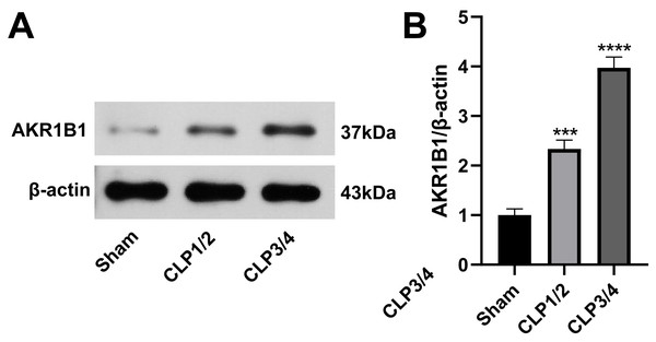 High expression of AKR1B1 in the renal tissue of the SA-AKI rat model.