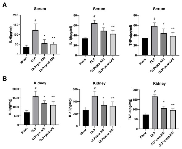 Changes in the inflammatory cytokine levels in the serum and renal tissues.