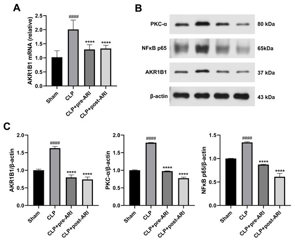 Epalrestat inhibits the activation of the AKR1B1/PKC/NFκB pathway.