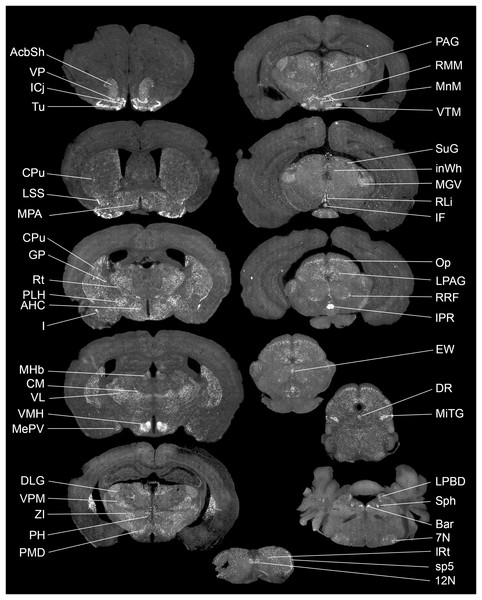 Brain distribution of Gpr149 mRNA in a C57Bl6 male mouse.