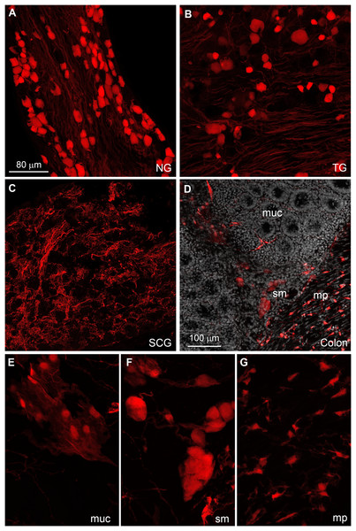 Distribution of Gpr149-Cre-tomato cells in the peripheral nervous system.