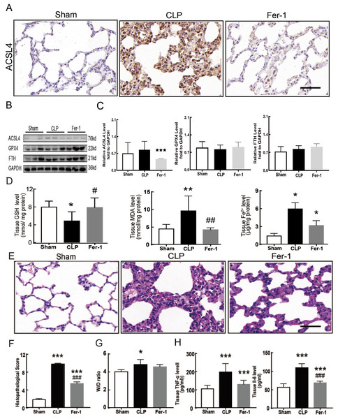 Ferroptosis inhibitor Fer-1 alleviated ALI.