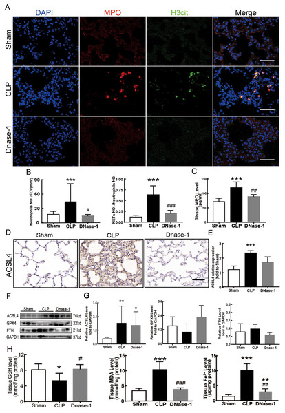 NETs inhibitor suppressed NETs formation and inhibited ferroptosis.