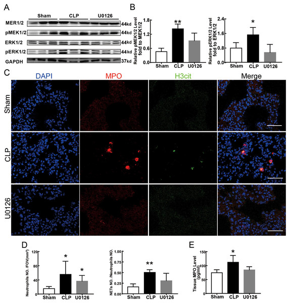 MEK inhibitor U0126 inhibited MEK-ERK pathway activation and reduced NETosis.