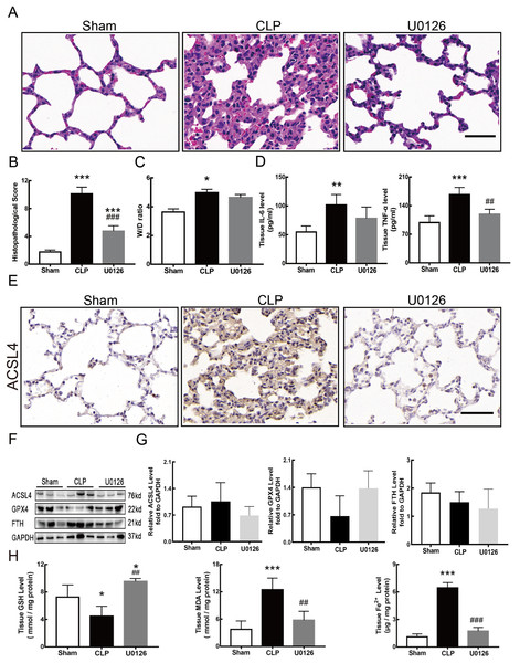 MEK inhibitor U0126 attenuated ALI and inhibited ferroptosis.