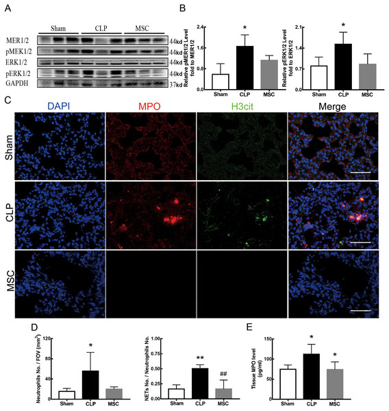 MSC inhibited MEK/ERK pathway activation and suprressed NETosis.