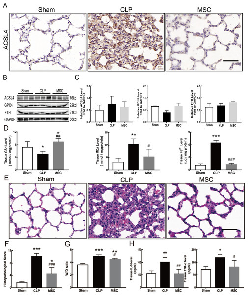 MSC inhibited ferroptosis and alleviated ALI.