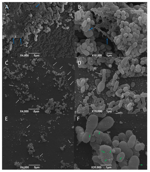 Representative scanning electron micrographs of the structure of mature C. pseudotuberculosis biofilms untreated (A and B) and treated with AgNPs at the concentration of 4 mg/mL (C, D, E and F).