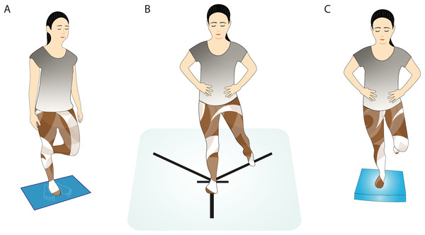 Monopodal postural stability measured by (A) stabilometry, (B) modified Star Excursion Balance test, and (C) Emery balance test.
