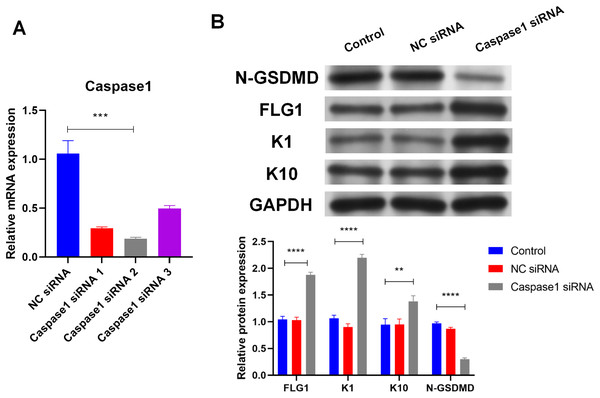 Caspase1-activated GSDMD inhibits human keratinocyte differentiation by reducing FLG expression.
