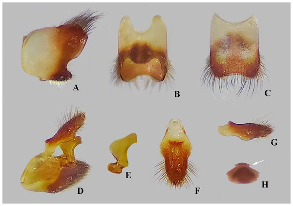 Male structures of Foveavelia dilatata (Polhemus & Polhemus, 1984), paratype from Brazil.