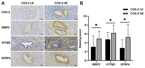 IHC of COX-2 pathway-related factors in adenomyosis.