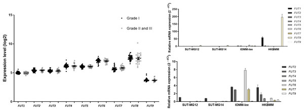 Fucosyltransferase (FUTs) expressions in benign and malignant meningiomas.