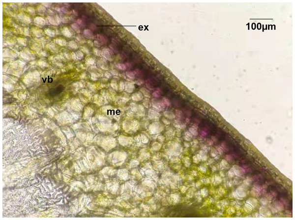 Distribution of Anthocyanins in HN191 fruits at 30 days after anthesis (DAA).