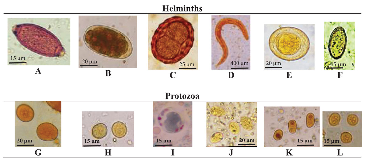 Prevalence of intestinal parasites and comparison of detection ...