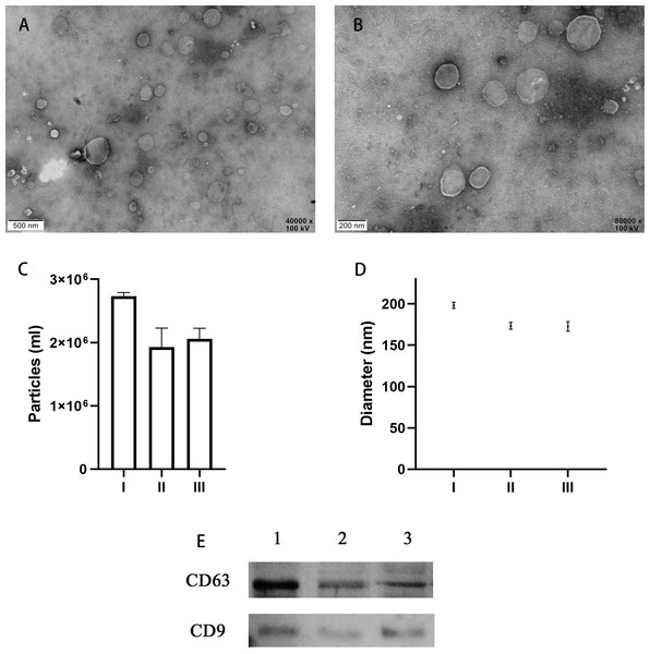 Characteristics of EVs isolated from uterine fluid.