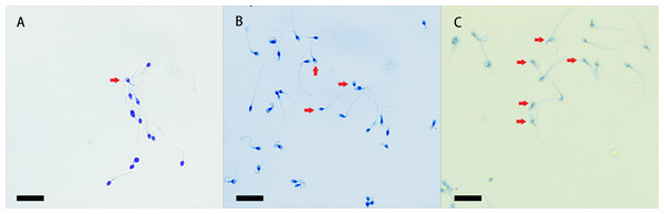 Coomassie brilliant blue staining of sperm acrosomes.