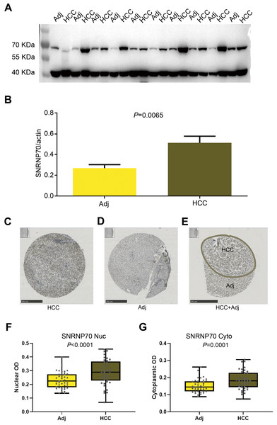 WB and the immunohistochemical experiments on SNRNP70.