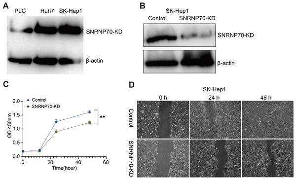 SNRNP70 inhibits proliferation and migration of HCC cells.