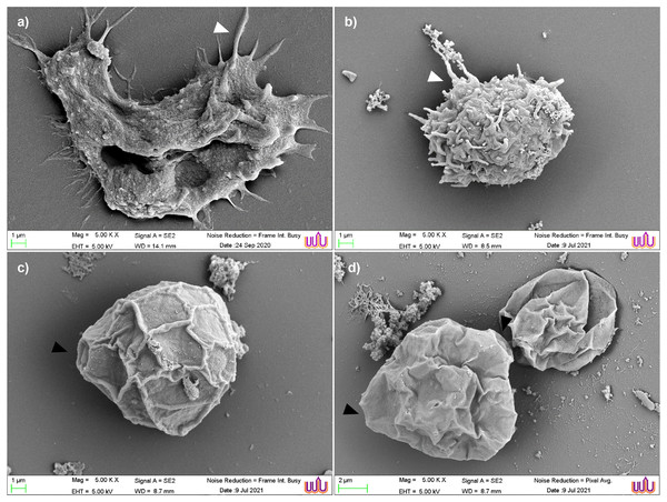 Scanning electron micrographs of parasite at various stages of encystation after exposure to the combined set of propolis extract and eye drops.