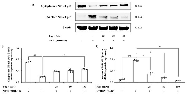 Pug-4 peptide inhibited NTHi-induced NF- κB activation in A549 cells.