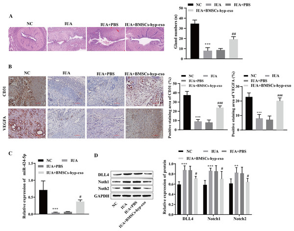 Hypoxic bone marrow mesenchymal stem cell exosomes improve endometrial injury in IUA rats.