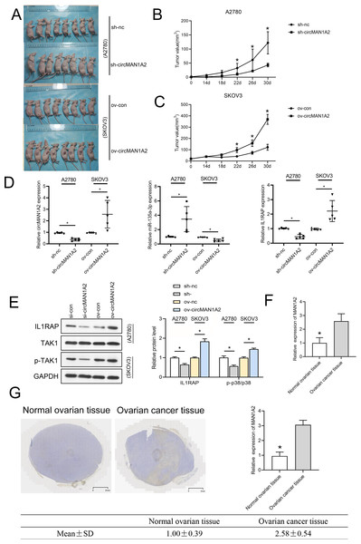 CircMAN1A2 accelerates xenograft tumor growth in vivo.