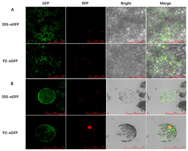 Subcellular localization of SCBV P2 in RFP-H2B transgenic Nicotiana benthamiana mesophyll cells and protoplasts.