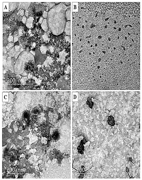 TEM micrographs of nanoparticles preparations.