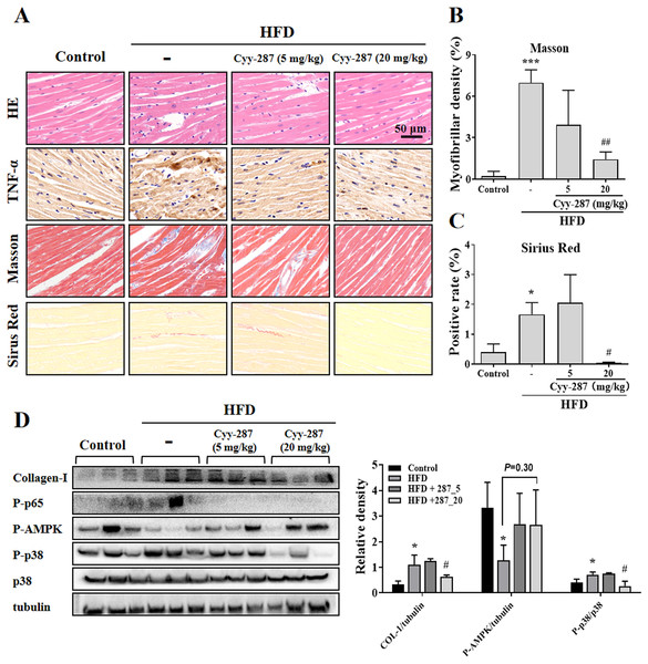 Cyy-287 attenuates myocardial inflammation and fibrosis by inhibiting p38 MAPK and activating AMPK in HFD mice.