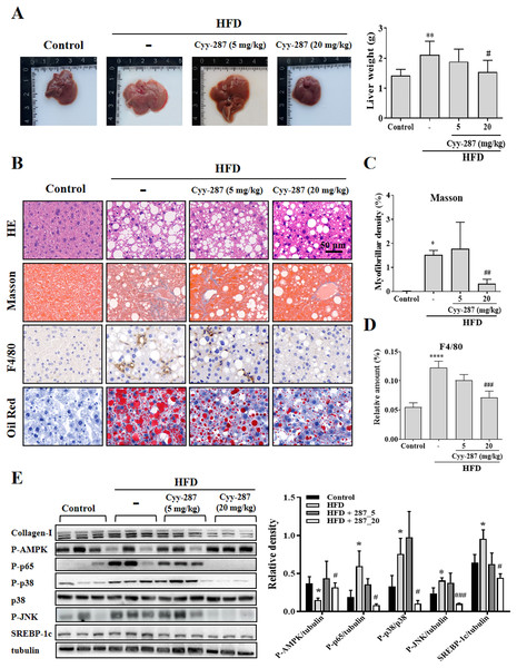 Cyy-287 mitigates hepatic fat accumulation and damage through MAPK/NF-κB dowregulation and activating AMPK in HFD mice.
