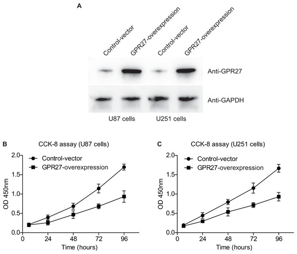GPR27-overexpression inhibit glioma progression.