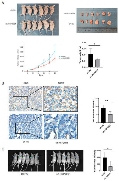 HSP90B1 promotes HNSC proliferation and metastasis in vivo.