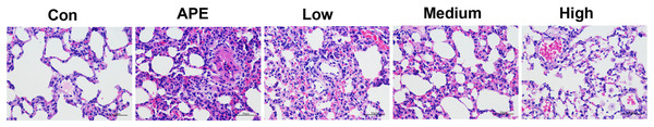R-hirudin ameliorated histopathological changes in lung tissues of APE rats (400 ×, bar = 50 µm).