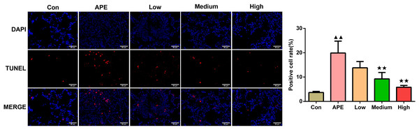 R-hirudin reduced cell apoptosis in lung tissues of APE rats (200 ×, bar = 50 µm).