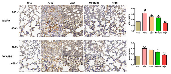 R-hirudin decreased expression of MMP9 and VCAM-1 in lung tissues of APE rats (200 ×, bar =100 µm; 400 ×, bar = 50 µm).