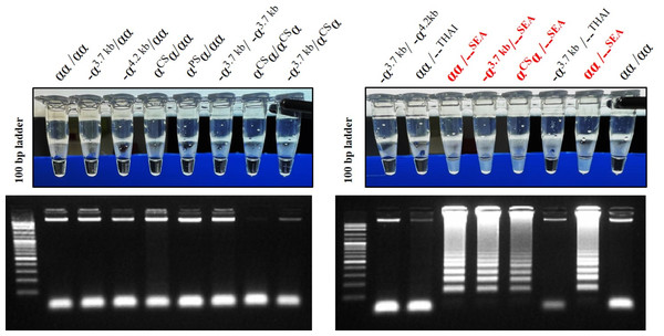 The specificity of developed LAMP turbidimetric assays for the detection of α0-thalassemia (SEA deletion) with gel electrophoresis related to different genotype.