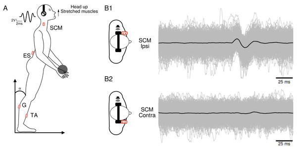 Subject’s position and electromyographic tracings.