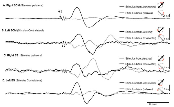 Spatial orientation of VEMP (SCM and ES-C).