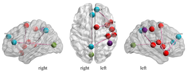 Diagrammatic representation of the relevant functional connections of important features in ESRD.