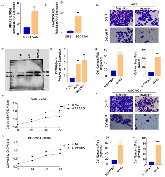 PPARG promotes the invasion and migration ability of gastric cancer cell lines.