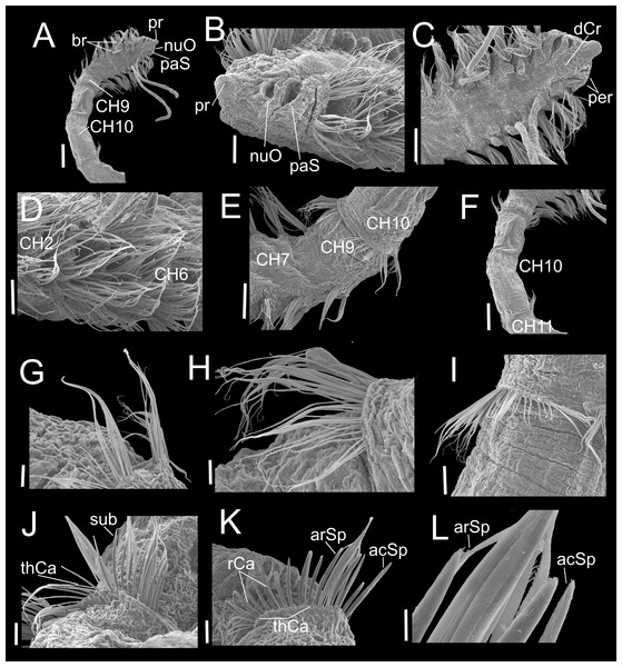 Heterospio variabilis sp. nov., with four branchial pairs (CNAP-ICML: MEB-PO–13–004/2018-GCA-CS).