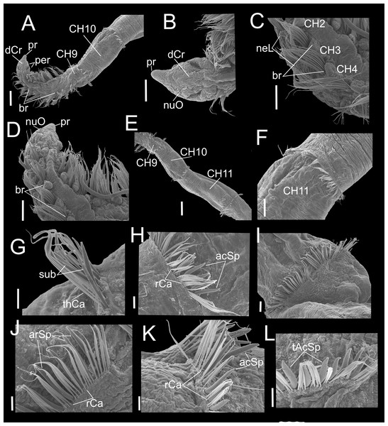 Heterospio variabilis sp. nov. with six branchial pairs (CNAP-ICML: MEB-PO–13–004/2022-GCA-CS).
