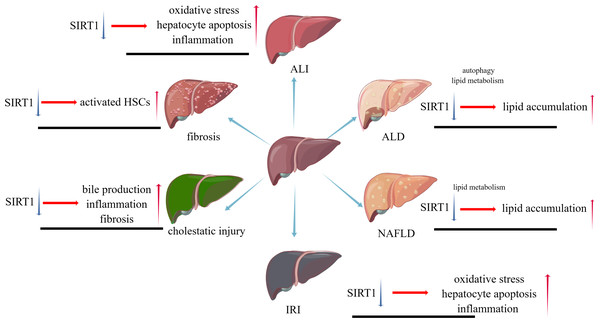 The pathophysiological changes caused by SIRT1 inhibition in different liver diseases.