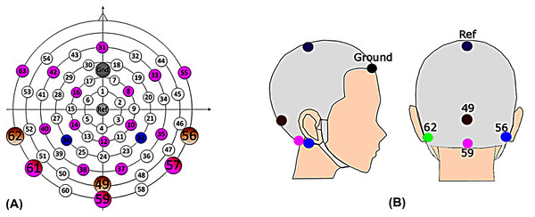 EEG cap.