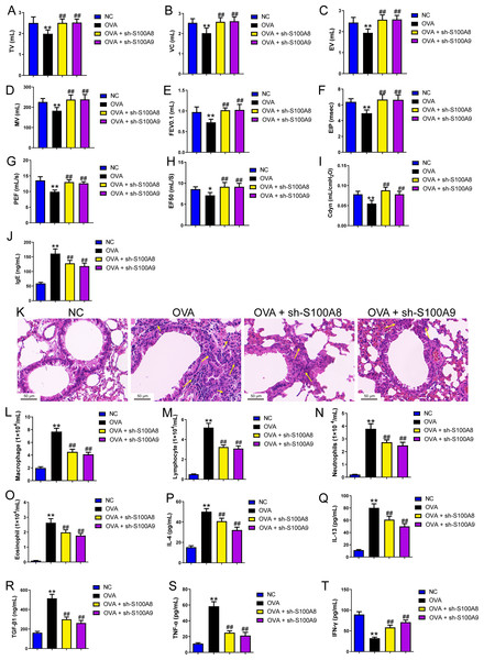S100A8/9 knockdown improved respiratory function, lung tissue injury and inflammation of broncho-alveolar lavage fluid in ovalbumin-sensitized and challenged mice.