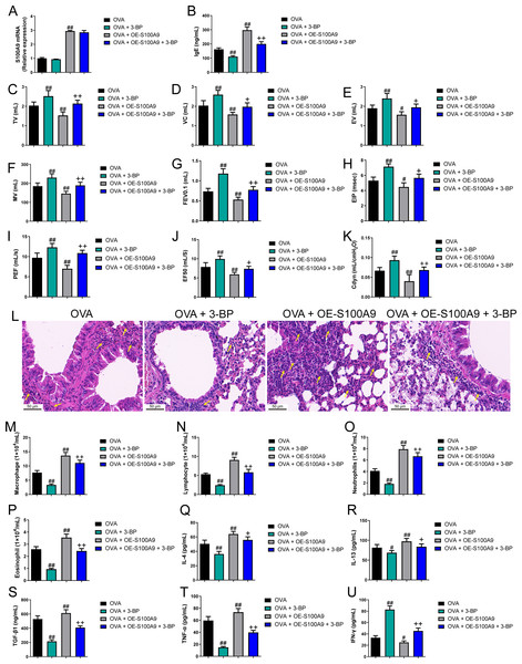 S100A9 overexpression had an adverse impact on respiratory function and lung tissue while enhancing inflammation in ovalbumin-sensitized and challenged mice.