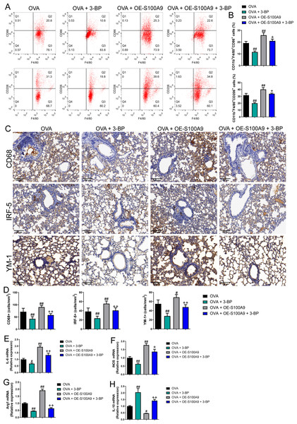 S100A9 overexpression promoted macrophage polarization in ovalbumin-sensitized and challenged mice.