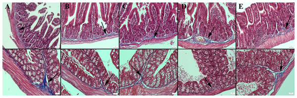 Masson trichrome staining in the ileum (upper row) and colon (below row).