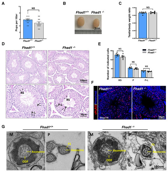 Fhad1−/−testes exhibit normal spermatogenesis.